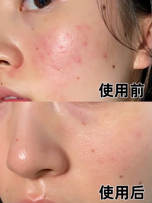 面霜十大适合追求年轻肌肤的人j9九游会俱乐部登录入口抗皱(图7)