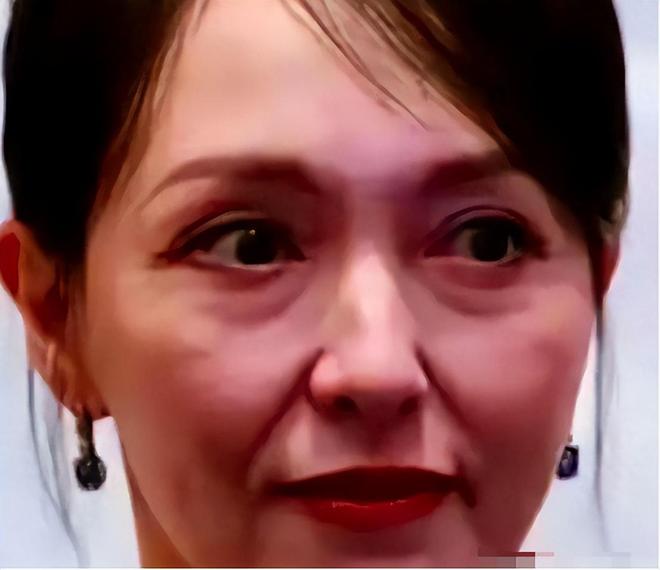 脸黑嘴大高圆圆露牙花王源疤痕遮不住j9九游会登录无滤镜大变样!赵露思(图8) 脸黑嘴大高圆圆露牙花王源疤痕遮不住j9九游会登录无滤镜大变样!赵露思(图8)