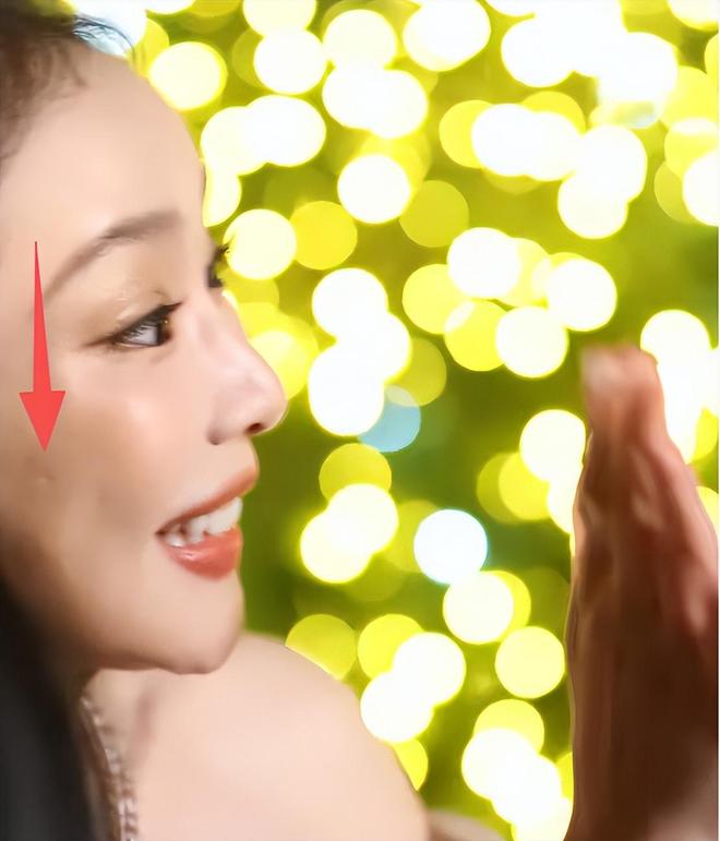 脸黑嘴大高圆圆露牙花王源疤痕遮不住j9九游会登录无滤镜大变样!赵露思(图16) 脸黑嘴大高圆圆露牙花王源疤痕遮不住j9九游会登录无滤镜大变样!赵露思(图16)