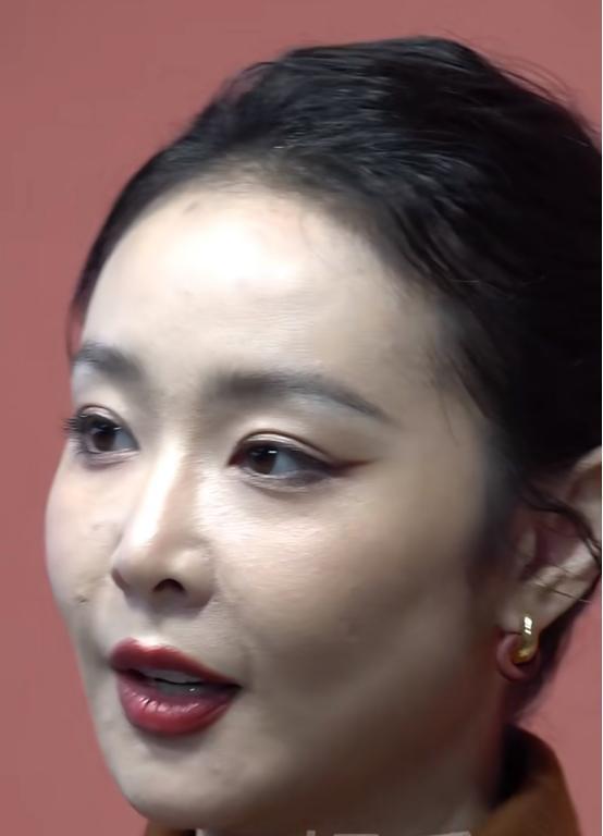 脸黑嘴大高圆圆露牙花王源疤痕遮不住j9九游会登录无滤镜大变样!赵露思(图9) 脸黑嘴大高圆圆露牙花王源疤痕遮不住j9九游会登录无滤镜大变样!赵露思(图9)