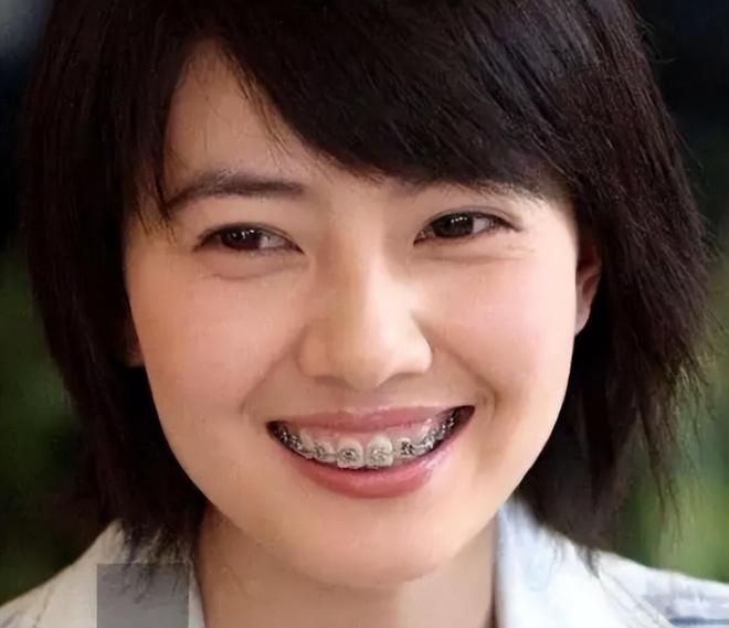 脸黑嘴大高圆圆露牙花王源疤痕遮不住j9九游会登录无滤镜大变样!赵露思(图15) 脸黑嘴大高圆圆露牙花王源疤痕遮不住j9九游会登录无滤镜大变样!赵露思(图15)