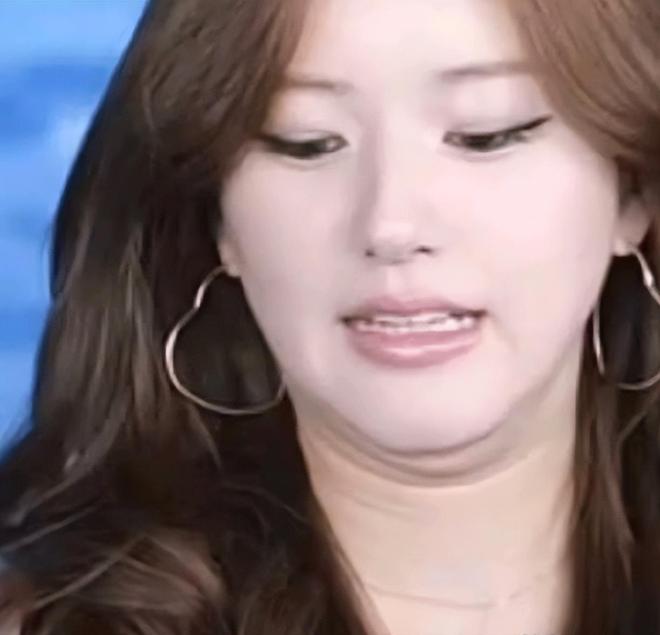 脸黑嘴大高圆圆露牙花王源疤痕遮不住j9九游会登录无滤镜大变样！赵露思(图10)