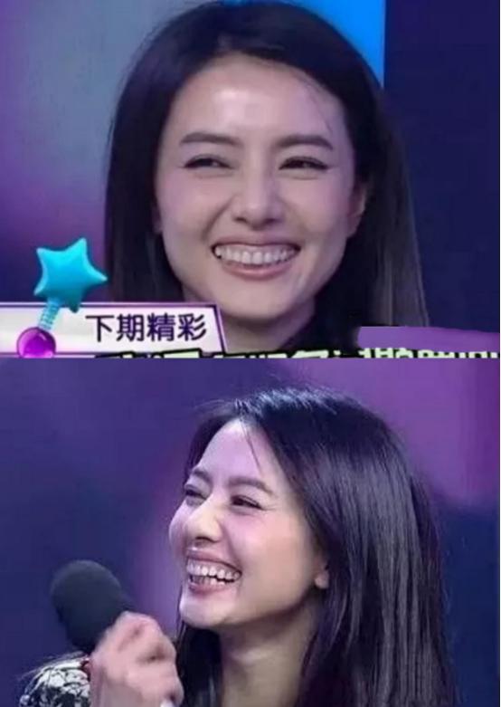 脸黑嘴大高圆圆露牙花王源疤痕遮不住j9九游会登录无滤镜大变样!赵露思(图13) 脸黑嘴大高圆圆露牙花王源疤痕遮不住j9九游会登录无滤镜大变样!赵露思(图13)