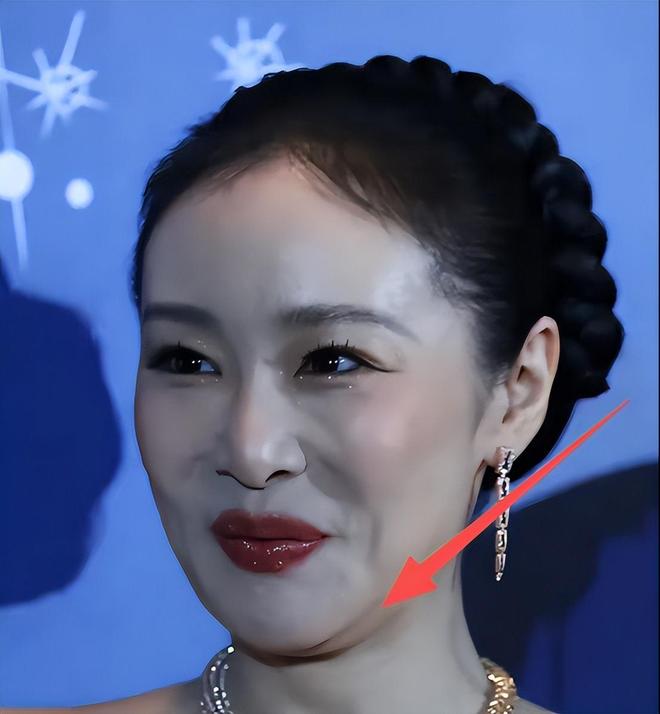 脸黑嘴大高圆圆露牙花王源疤痕遮不住j9九游会登录无滤镜大变样!赵露思(图18) 脸黑嘴大高圆圆露牙花王源疤痕遮不住j9九游会登录无滤镜大变样!赵露思(图18)